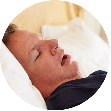 Sleep Apnea Treatment in Frisco, TX